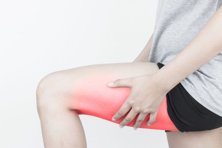 Woman holding pulled hamstring